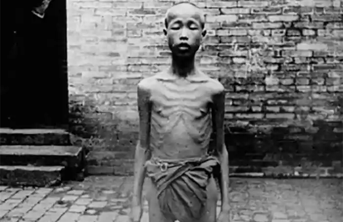This famine victim in China (Chinese Famine of 1907)